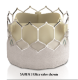 SAPIEN 3 Ultra transcatheter heart valve